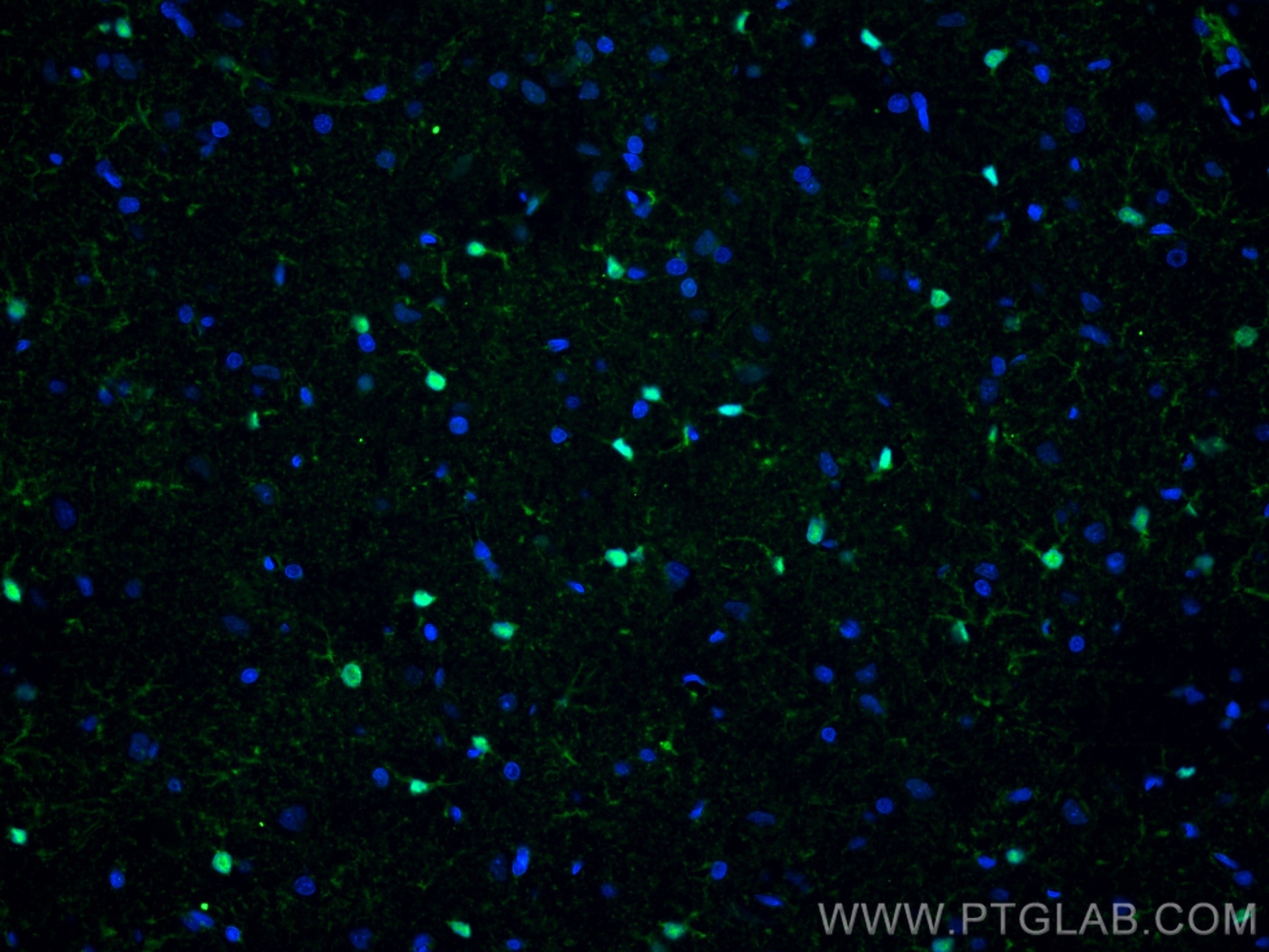 IF Staining of rat brain using 66616-1-Ig