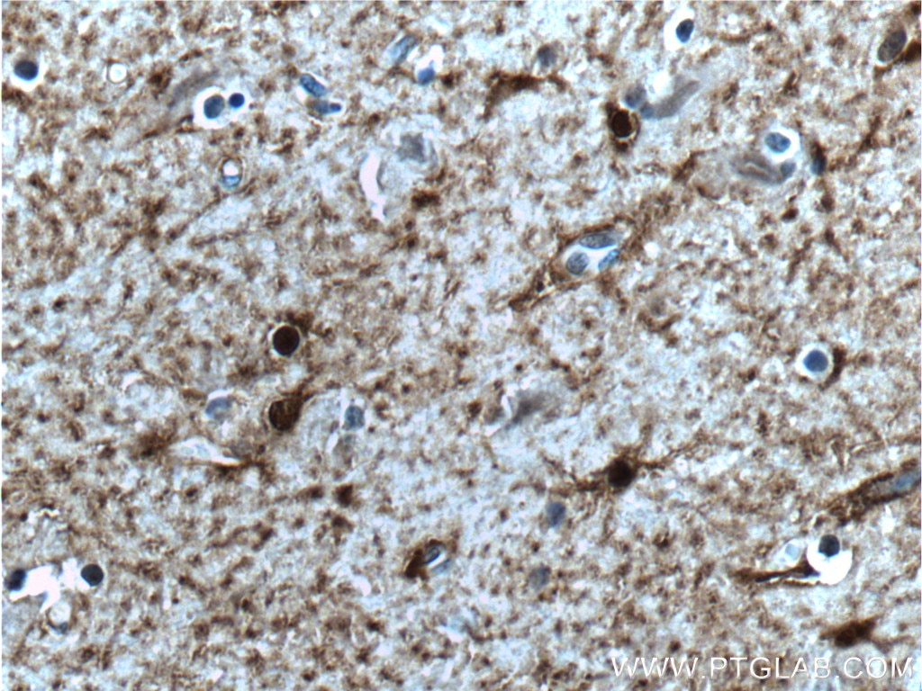 IHC staining of human brain using 66616-1-Ig