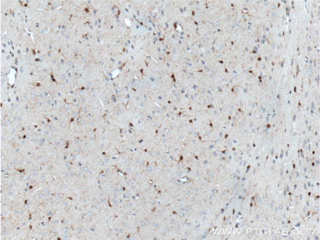 Immunohistochemistry (IHC) staining of mouse brain tissue using S100 Beta Monoclonal antibody (66616-1-Ig)