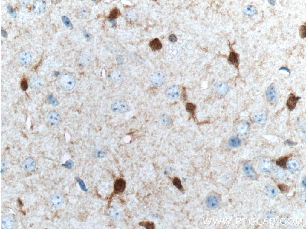 Immunohistochemistry (IHC) staining of mouse brain tissue using S100 Beta Monoclonal antibody (66616-1-Ig)