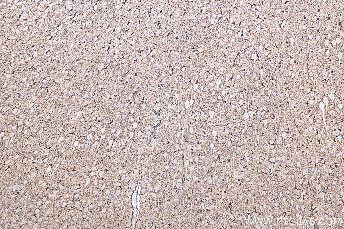 IHC staining of rat brain using 66616-1-Ig Immunohistochemistry (IHC) staining of rat brain tissue using S100B Monoclonal antibody (66616-1-Ig)