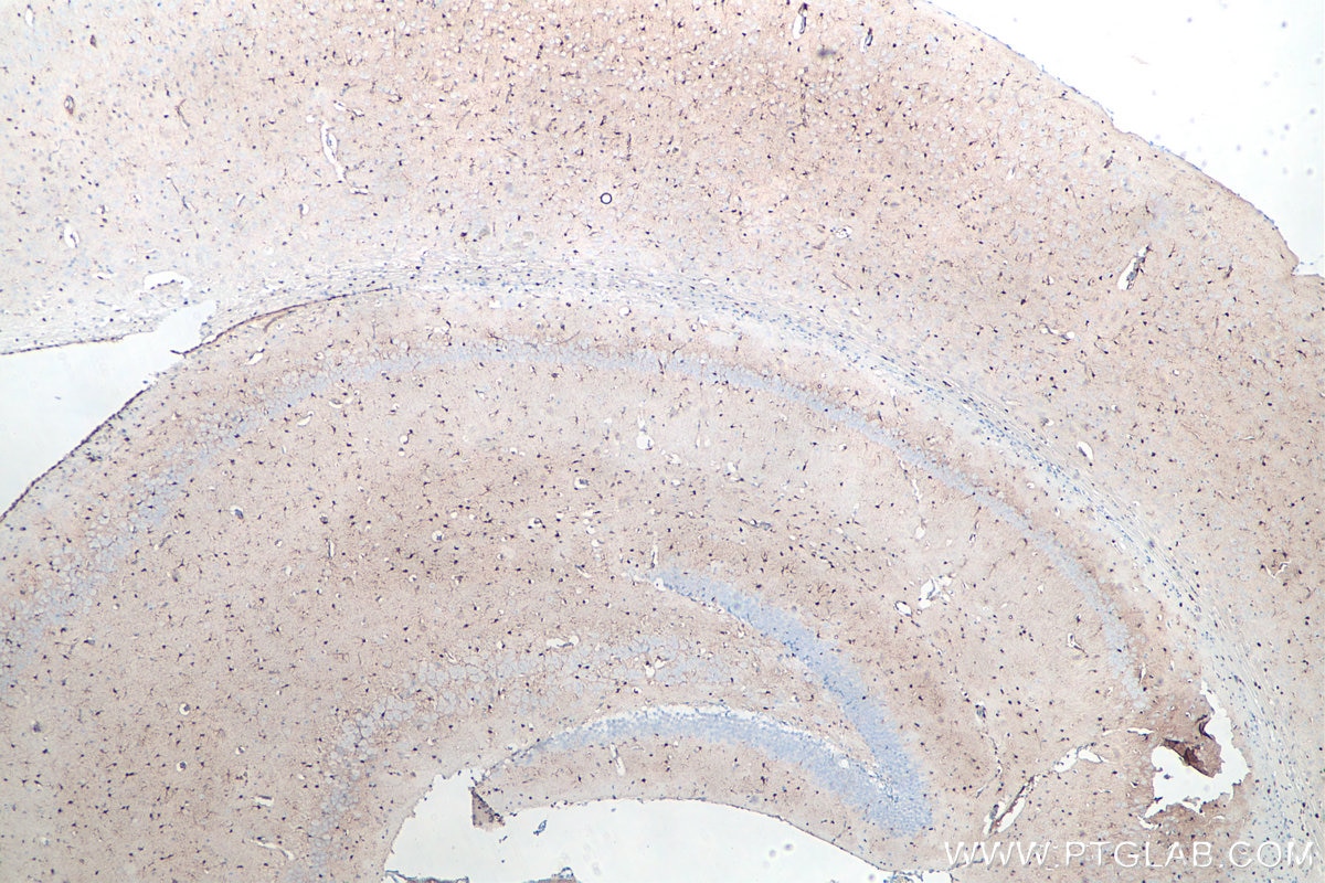 IHC staining of mouse brain using 66616-1-Ig Immunohistochemistry (IHC) staining of mouse brain tissue using S100B Monoclonal antibody (66616-1-Ig)