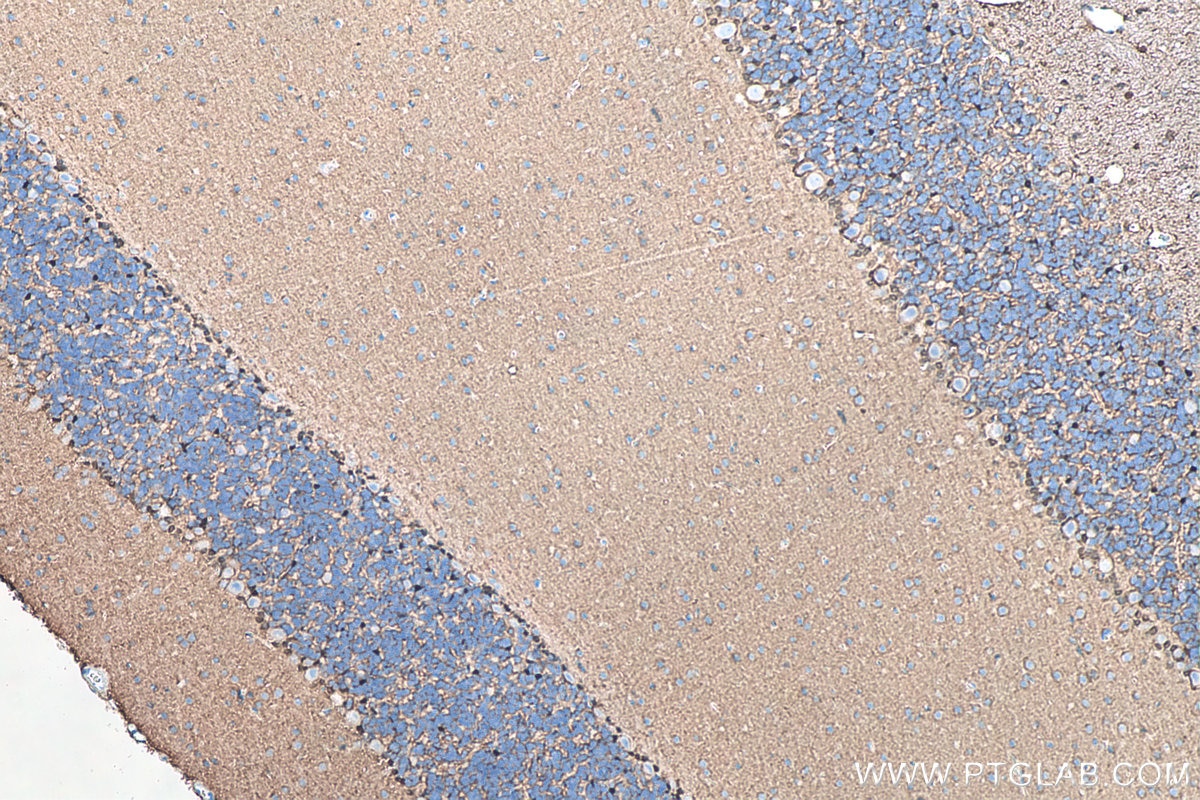 IHC staining of rat cerebellum using 66616-1-Ig Immunohistochemistry (IHC) staining of rat cerebellum tissue using S100B Monoclonal antibody (66616-1-Ig)