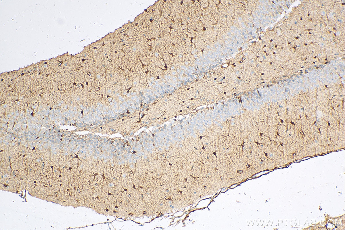 IHC staining of rat brain using 66616-1-Ig