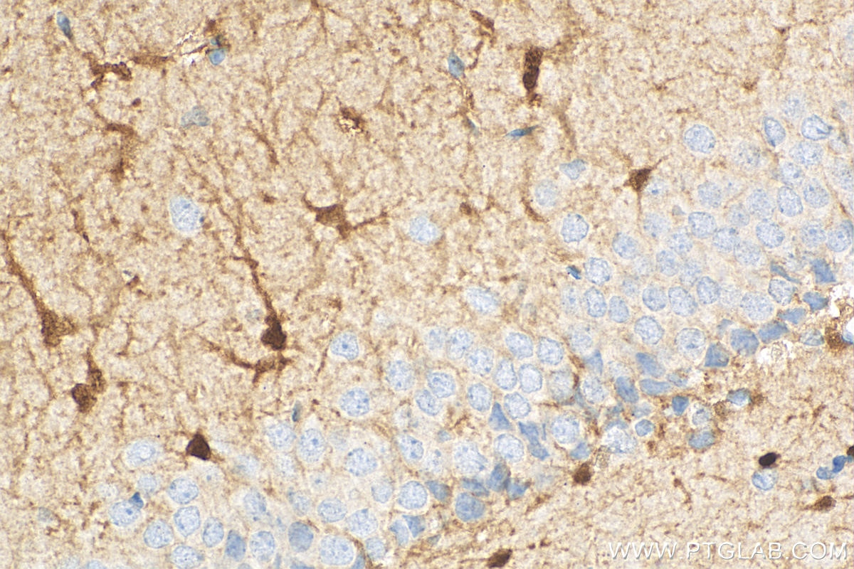 Immunohistochemistry (IHC) staining of rat brain tissue using S100 Beta Monoclonal antibody (66616-1-Ig)