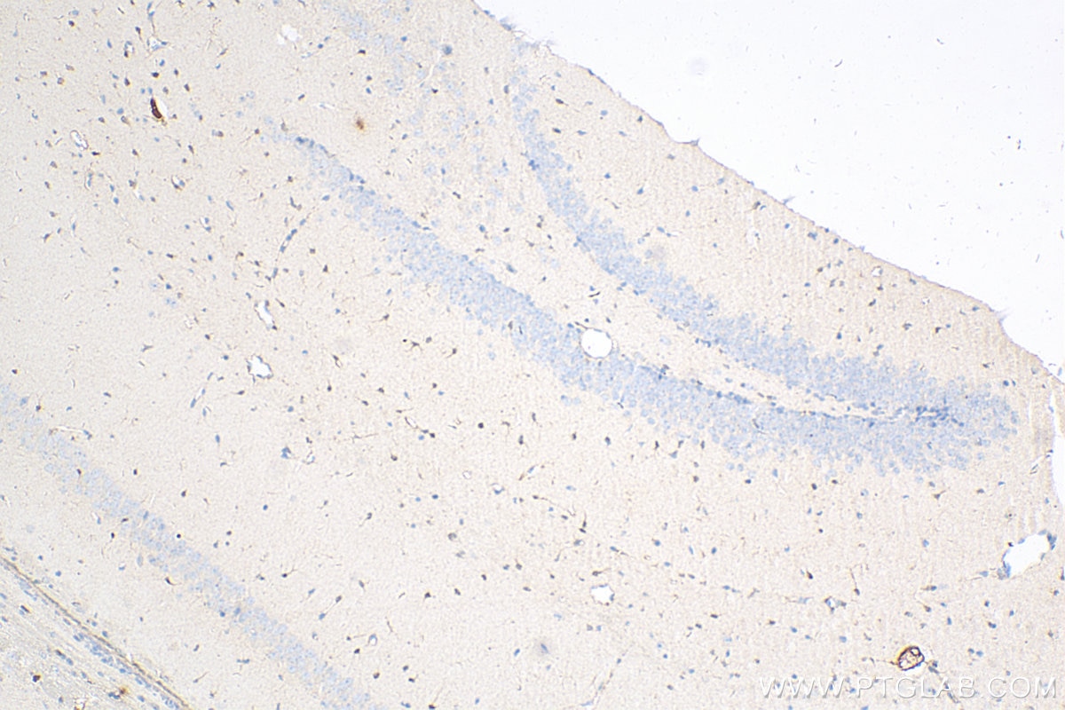 IHC staining of mouse brain using 66616-1-Ig