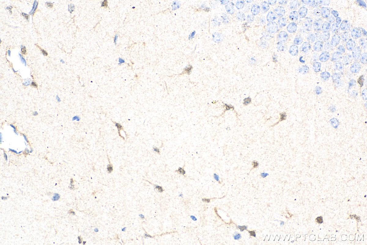 Immunohistochemistry (IHC) staining of mouse brain tissue using S100 Beta Monoclonal antibody (66616-1-Ig)