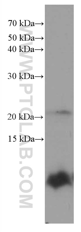 Western Blot (WB) analysis of pig brain tissue using S100 Beta Monoclonal antibody (66616-1-Ig)