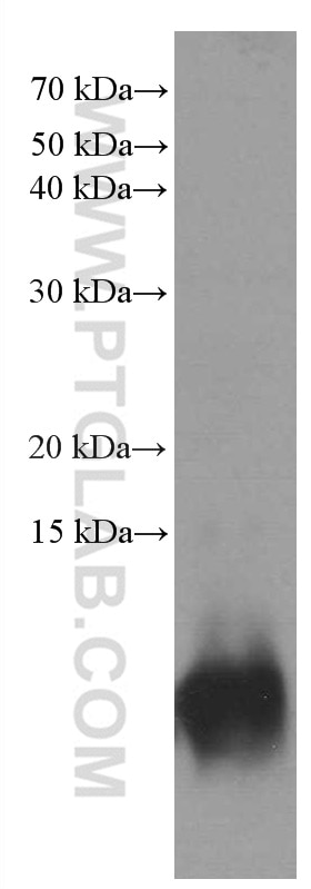 Western Blot (WB) analysis of rat brain tissue using S100 Beta Monoclonal antibody (66616-1-Ig)