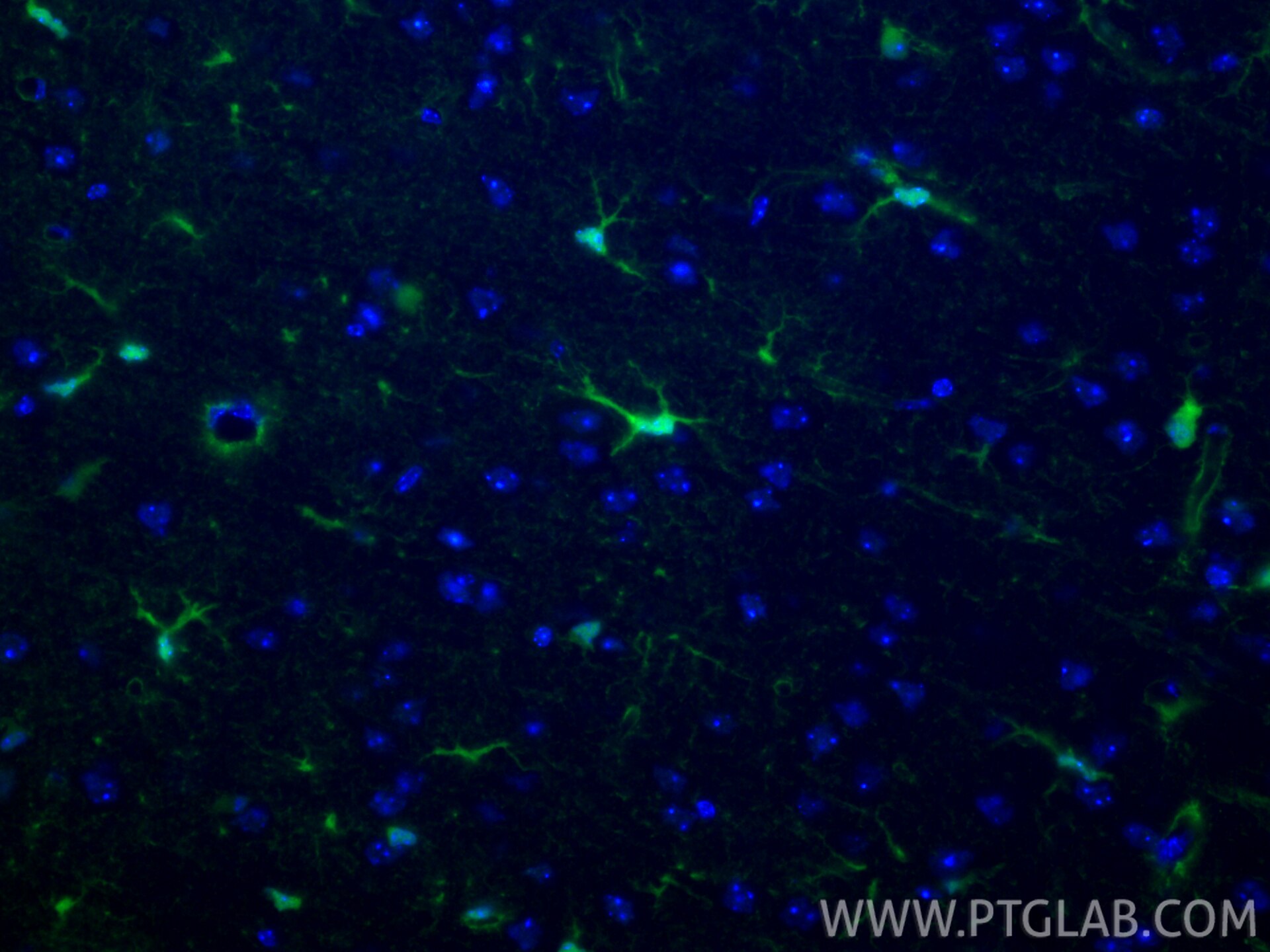Immunofluorescence (IF) / fluorescent staining of mouse brain tissue using CoraLite® Plus 488-conjugated S100B Recombinant mo (CL488-82271-8)