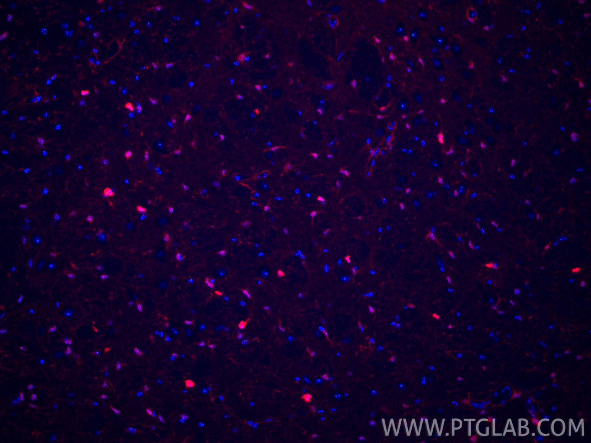 Immunofluorescent analysis of (4% PFA) fixed paraffin-embedded mouse brain tissue using CoraLite®594 S100B antibody (CL594-82271-8, Clone: 1E2 ) at dilution of 1:200. Heat mediated antigen retrieval with Tris-EDTA buffer (pH 9.0). Immunofluorescence (IF) / fluorescent staining of mouse brain tissue using CoraLite®594-conjugated S100B Recombinant monoclon (CL594-82271-8)