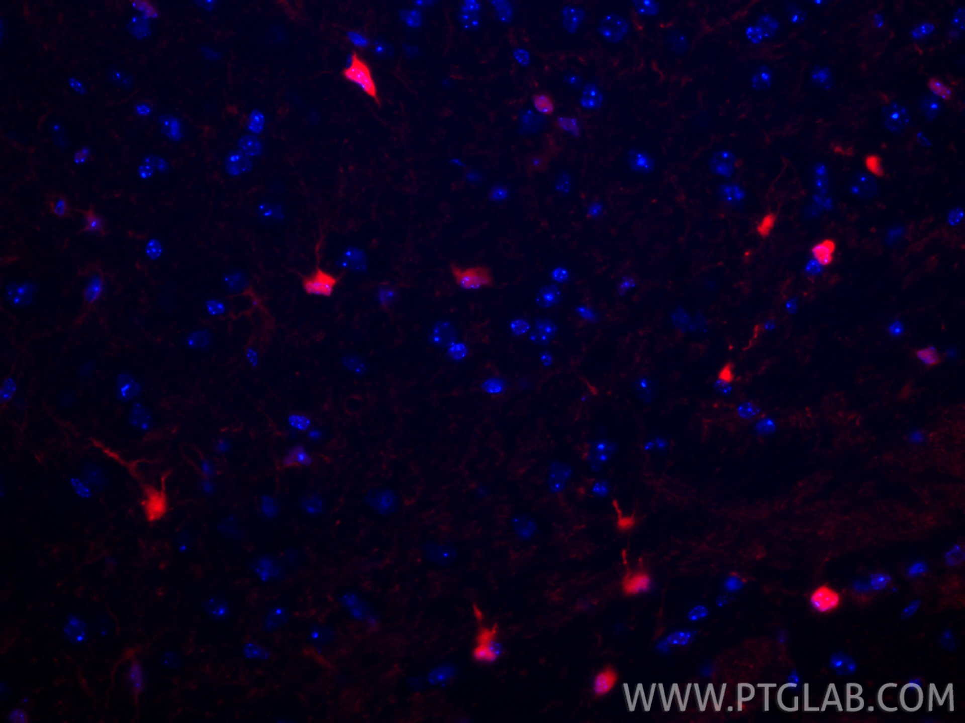 Immunofluorescent analysis of (4% PFA) fixed paraffin-embedded mouse brain tissue using CoraLite®594 S100B antibody (CL594-82271-8, Clone: 1E2 ) at dilution of 1:200. Heat mediated antigen retrieval with Tris-EDTA buffer (pH 9.0). Immunofluorescence (IF) / fluorescent staining of mouse brain tissue using CoraLite®594-conjugated S100B Recombinant monoclon (CL594-82271-8)