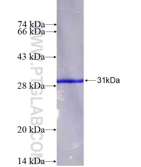 S100B fusion protein Ag26763 SDS-PAGE