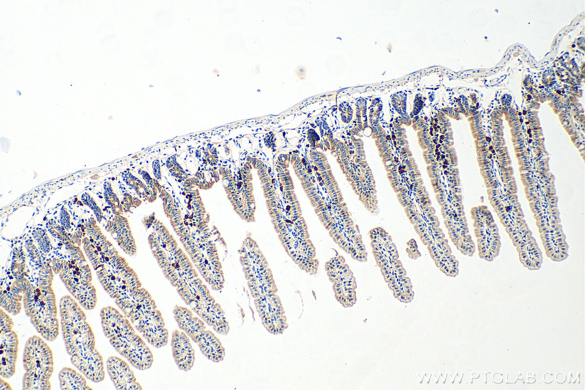 Immunohistochemistry (IHC) staining of mouse small intestine tissue using S100G/Calbindin-D9k Polyclonal antibody (18340-1-AP)