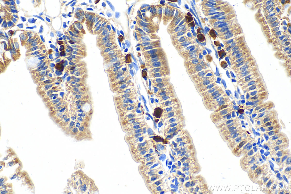 Immunohistochemistry (IHC) staining of mouse small intestine tissue using S100G/Calbindin-D9k Polyclonal antibody (18340-1-AP)