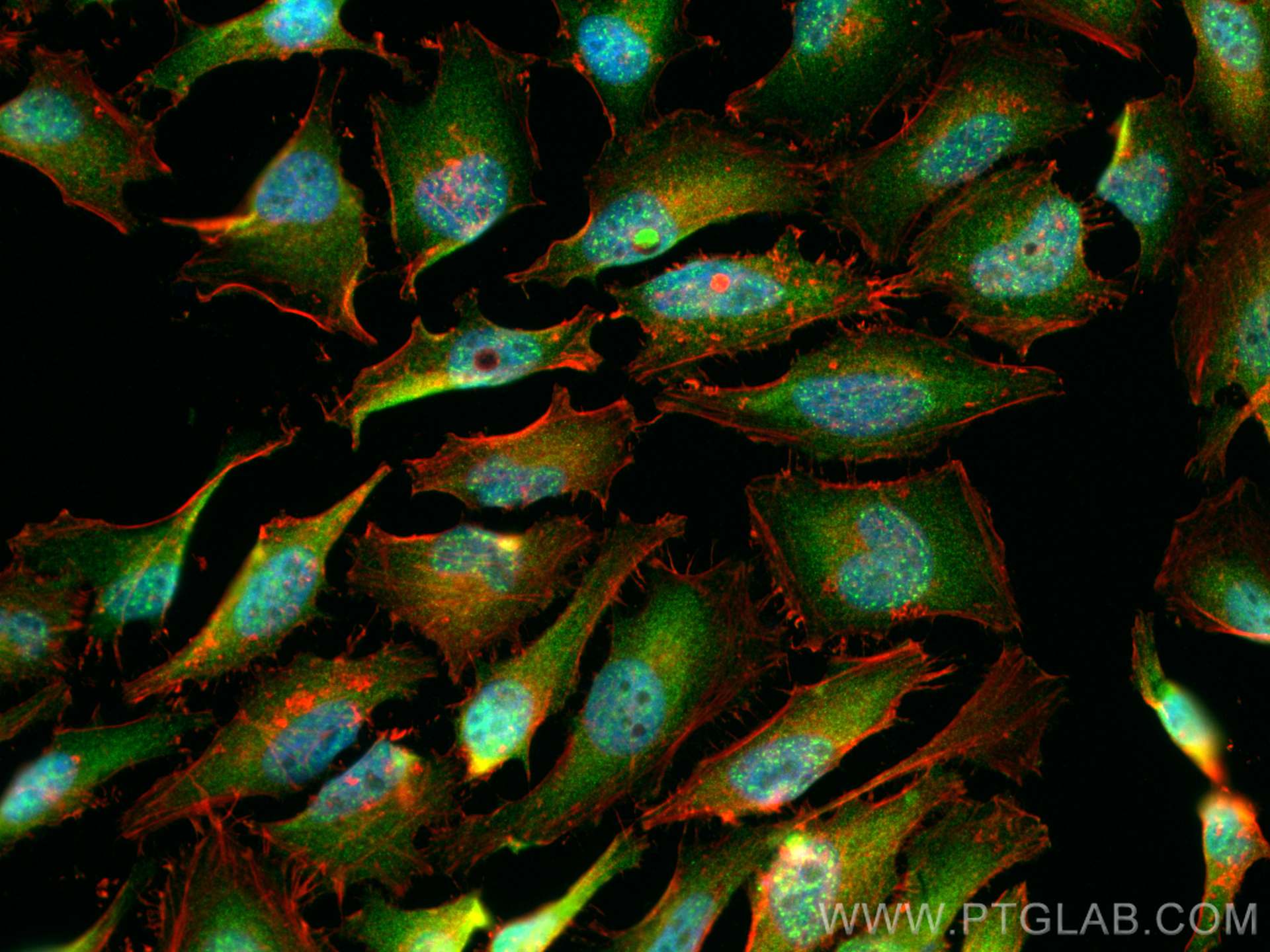 Immunofluorescence (IF) / fluorescent staining of HeLa cells using S100P Polyclonal antibody (11803-1-AP)