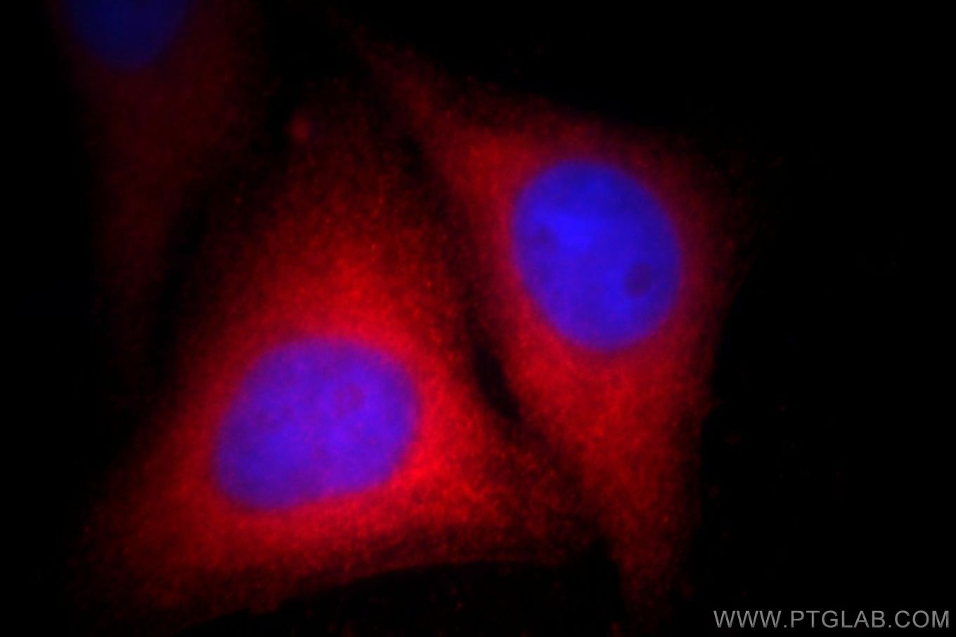 Immunofluorescence (IF) / fluorescent staining of HepG2 cells using S100P Polyclonal antibody (11803-1-AP)
