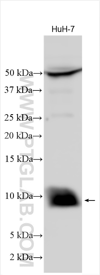Western Blot (WB) analysis of various lysates using S100P Polyclonal antibody (11803-1-AP)