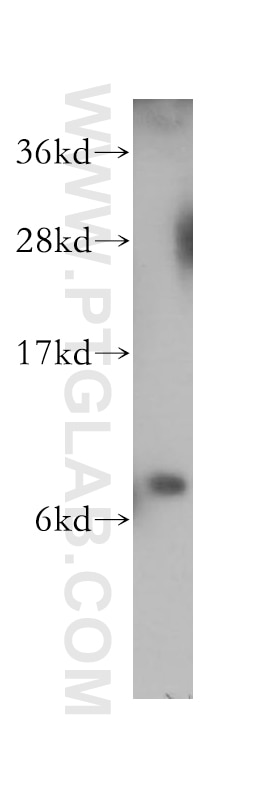Western Blot (WB) analysis of HeLa cells using S100P Polyclonal antibody (11803-1-AP)