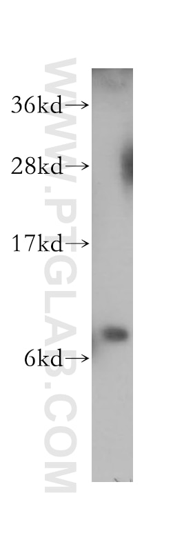 WB analysis of HeLa using 11803-1-AP