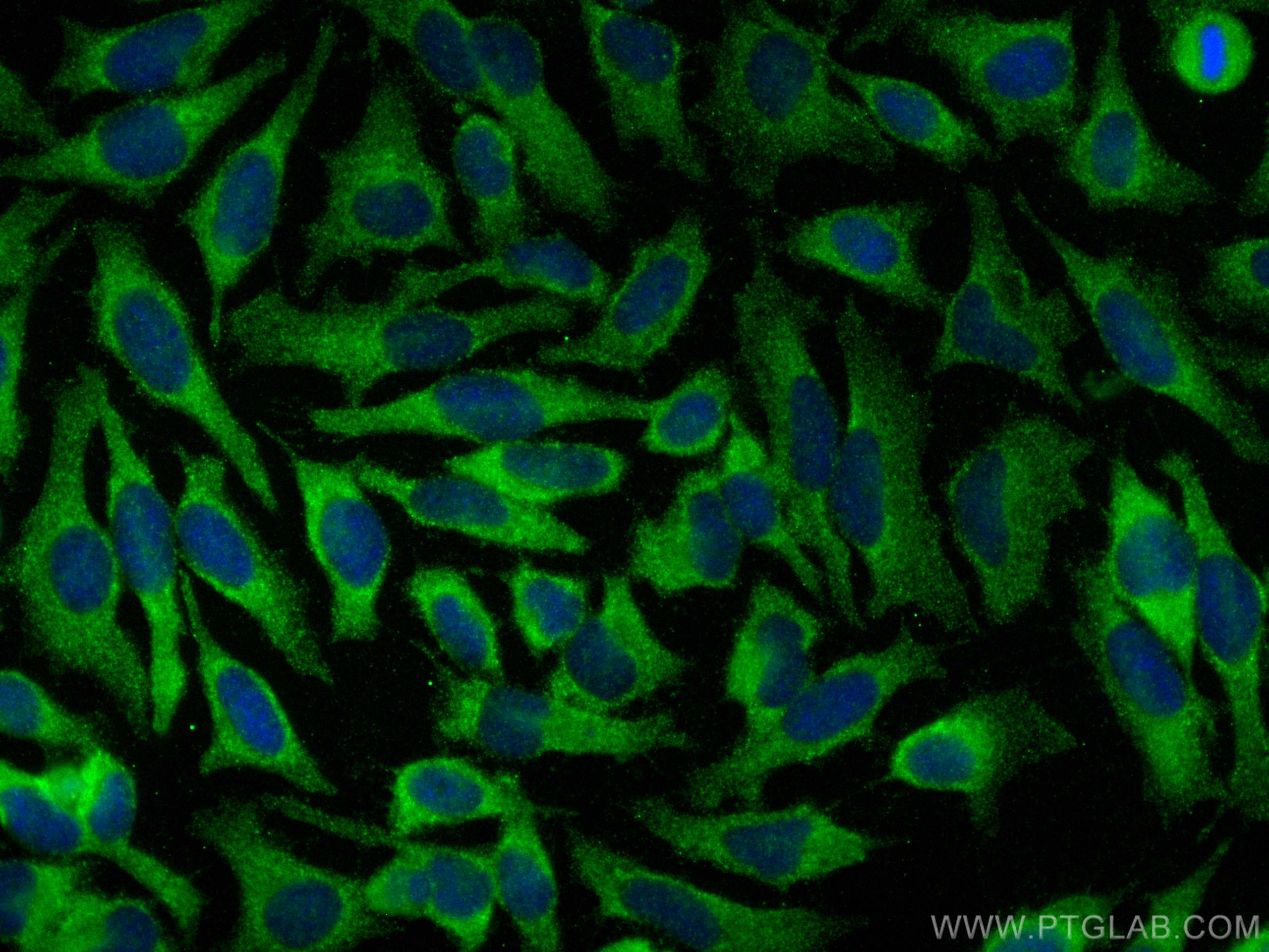 Immunofluorescence (IF) / fluorescent staining of HeLa cells using S100P Monoclonal antibody (67485-1-Ig)