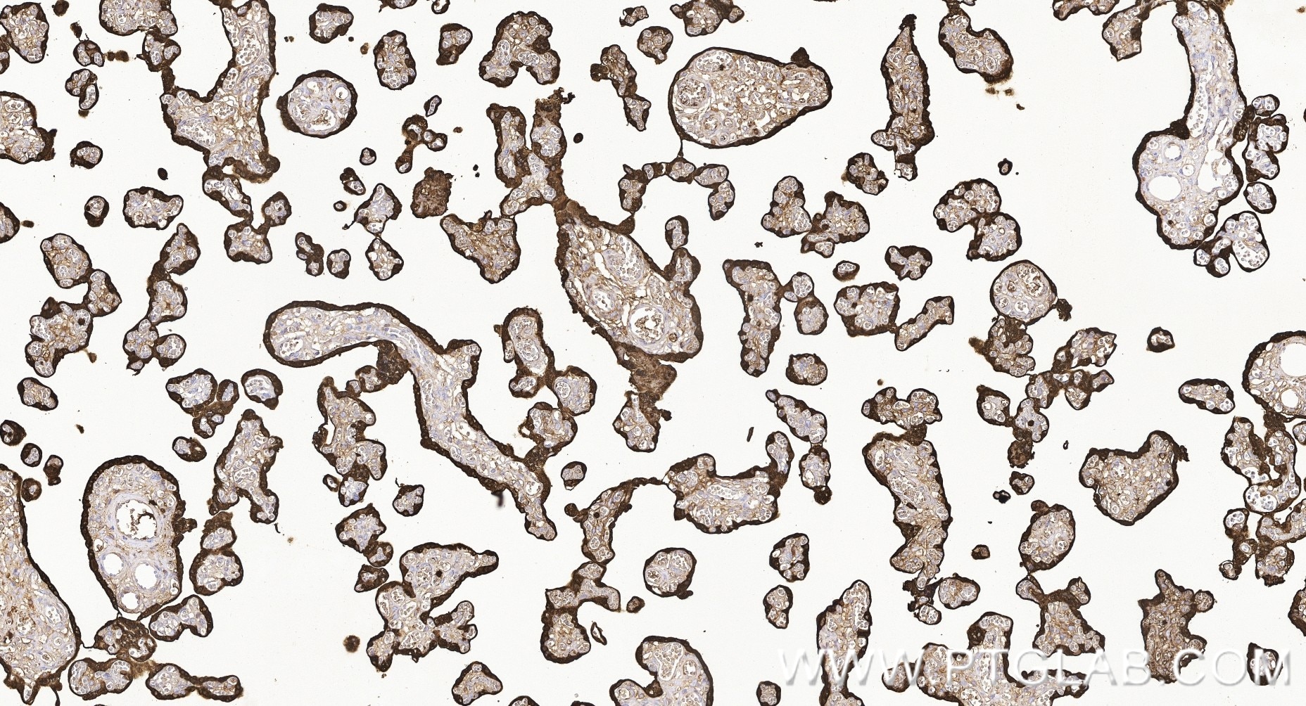 IHC staining of human placenta using 88256-7-RR (same clone as 88256-7-PBS) Immunohistochemistry (IHC) staining of human placenta tissue using S100P Recombinant monoclonal antibody (88256-7-RR)