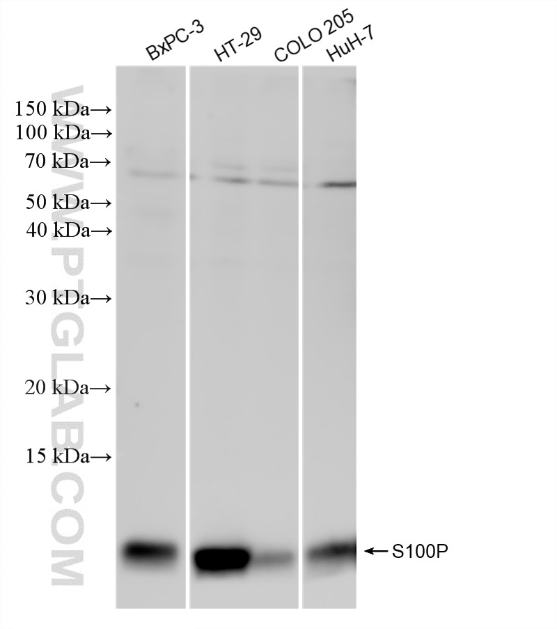 WB analysis using 88256-7-RR (same clone as 88256-7-PBS) Western Blot (WB) analysis of various lysates using S100P Recombinant monoclonal antibody (88256-7-RR)