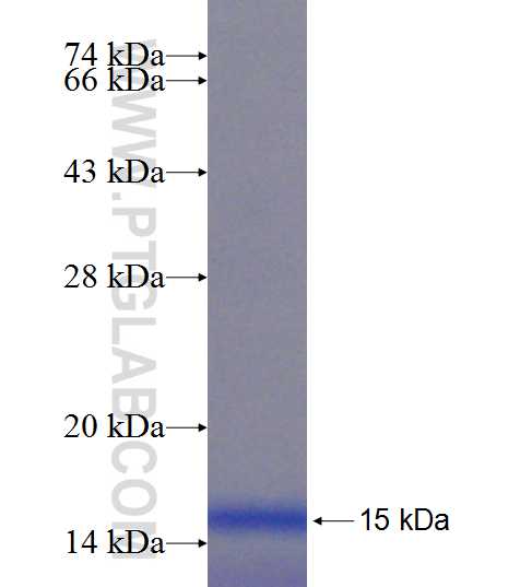 S100P fusion protein Ag19115 SDS-PAGE