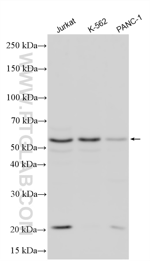 Western Blot (WB) analysis of various lysates using S100PBP Polyclonal antibody (33562-1-AP)