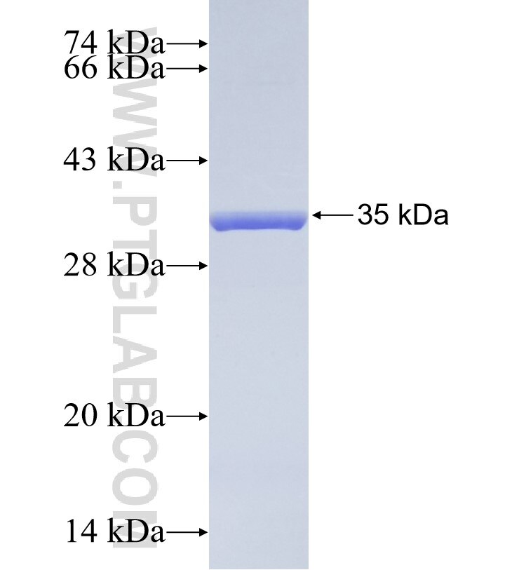 S100a10 fusion protein Ag35034 SDS-PAGE