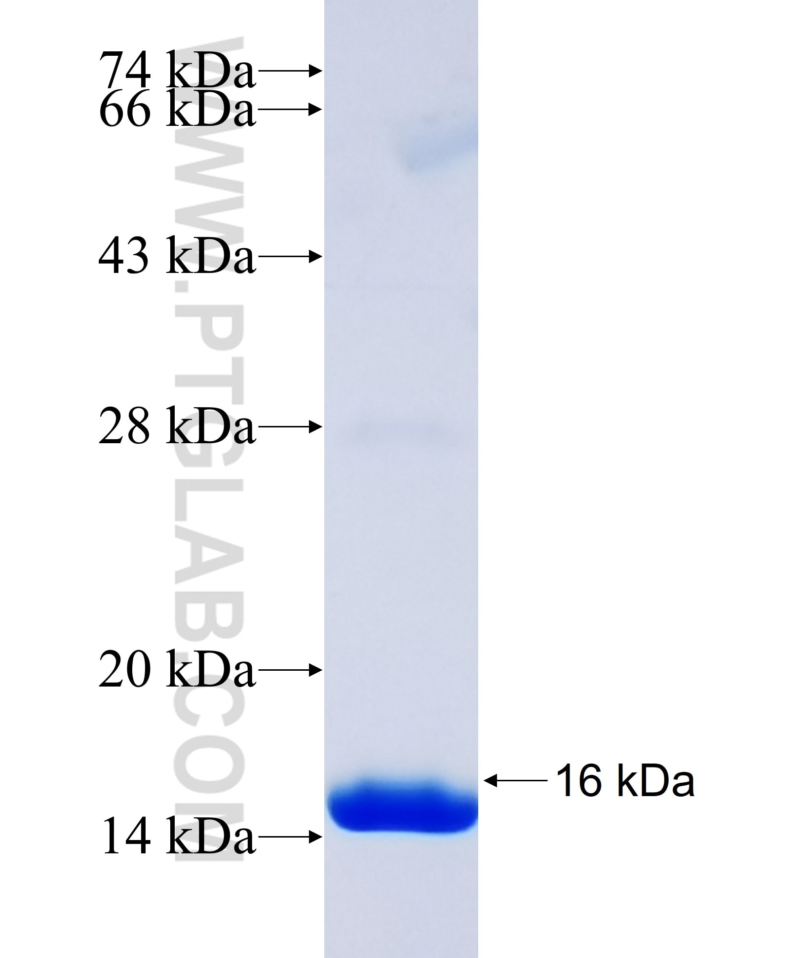 S100a10 fusion protein Ag35047 SDS-PAGE