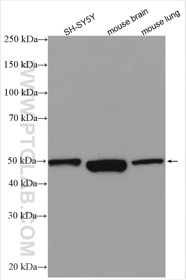 Western Blot (WB) analysis of various lysates using S1PR1 Polyclonal antibody (29318-1-AP)
