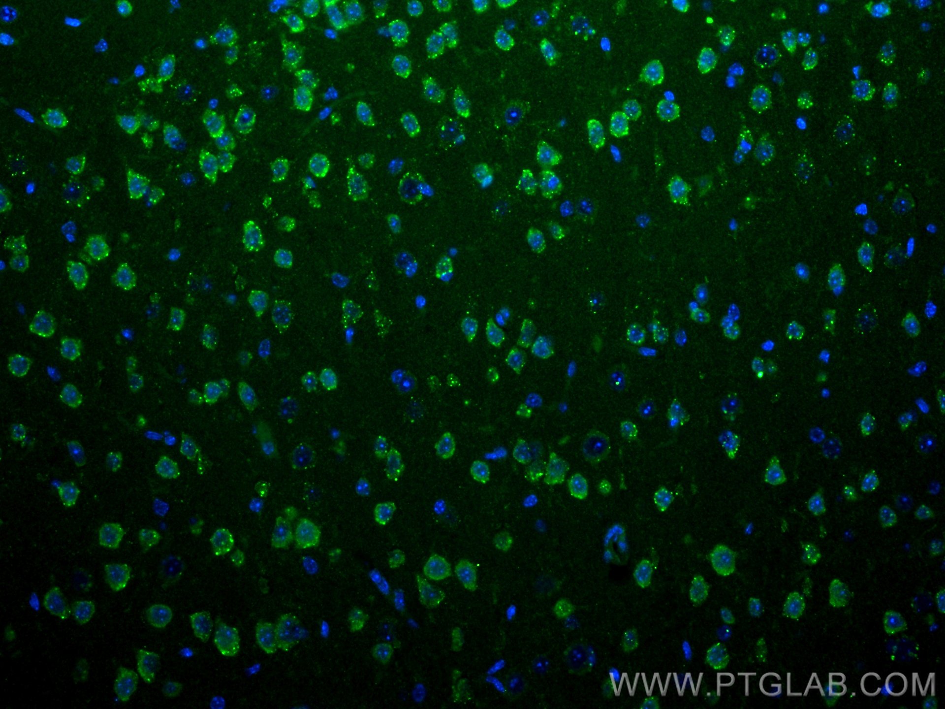 Immunofluorescence (IF) / fluorescent staining of mouse brain tissue using S1PR2 Polyclonal antibody (21180-1-AP)