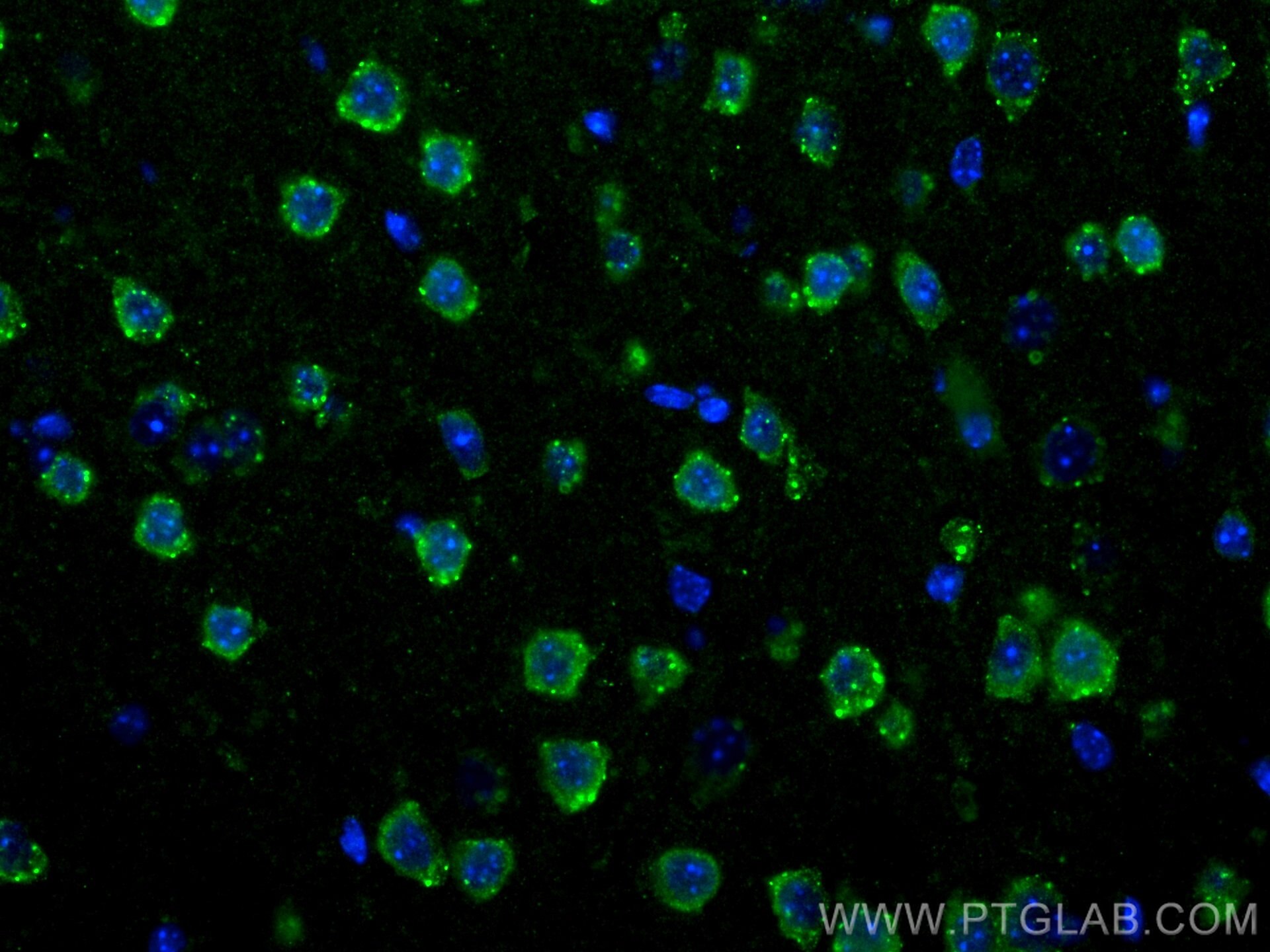 Immunofluorescence (IF) / fluorescent staining of mouse brain tissue using S1PR2 Polyclonal antibody (21180-1-AP)