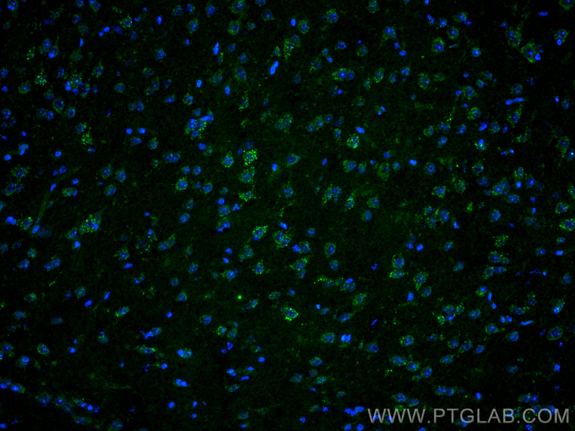 Immunofluorescence (IF) / fluorescent staining of mouse brain tissue using S1PR2 Polyclonal antibody (21180-1-AP)
