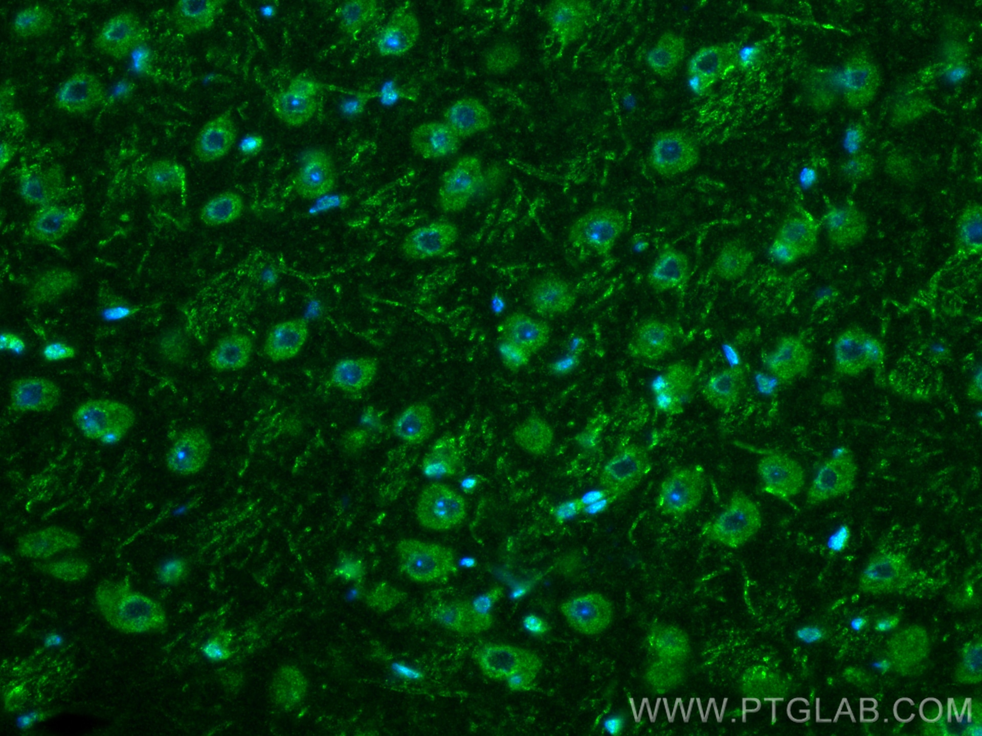 Immunofluorescence (IF) / fluorescent staining of mouse brain tissue using S1PR2 Polyclonal antibody (21180-1-AP)