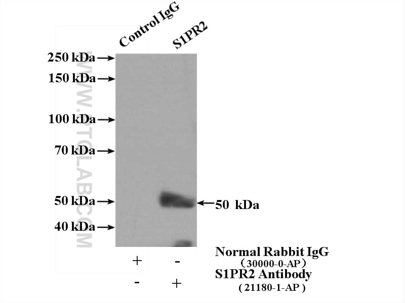 S1PR2 Polyclonal antibody