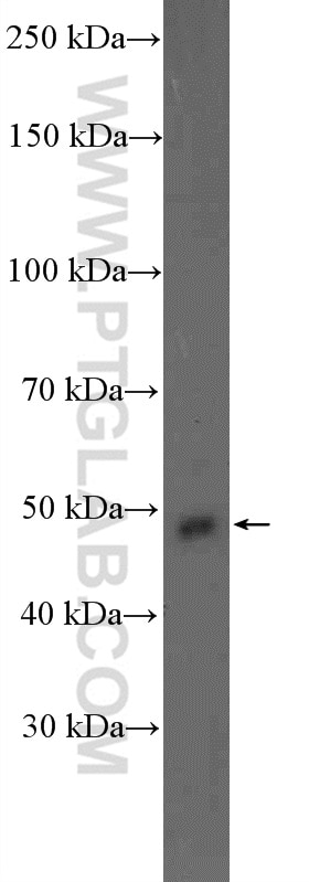 Western Blot (WB) analysis of HeLa cells using S1PR2 Polyclonal antibody (21180-1-AP)