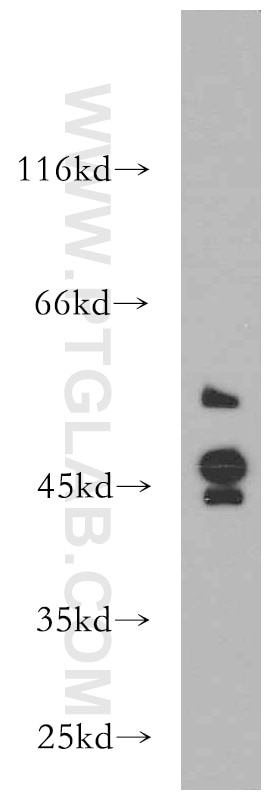 Western Blot (WB) analysis of MCF-7 cells using S1PR2 Polyclonal antibody (21180-1-AP)