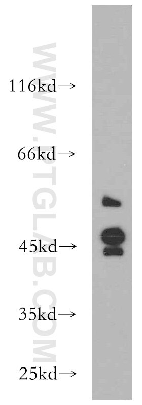 WB analysis of MCF-7 using 21180-1-AP
