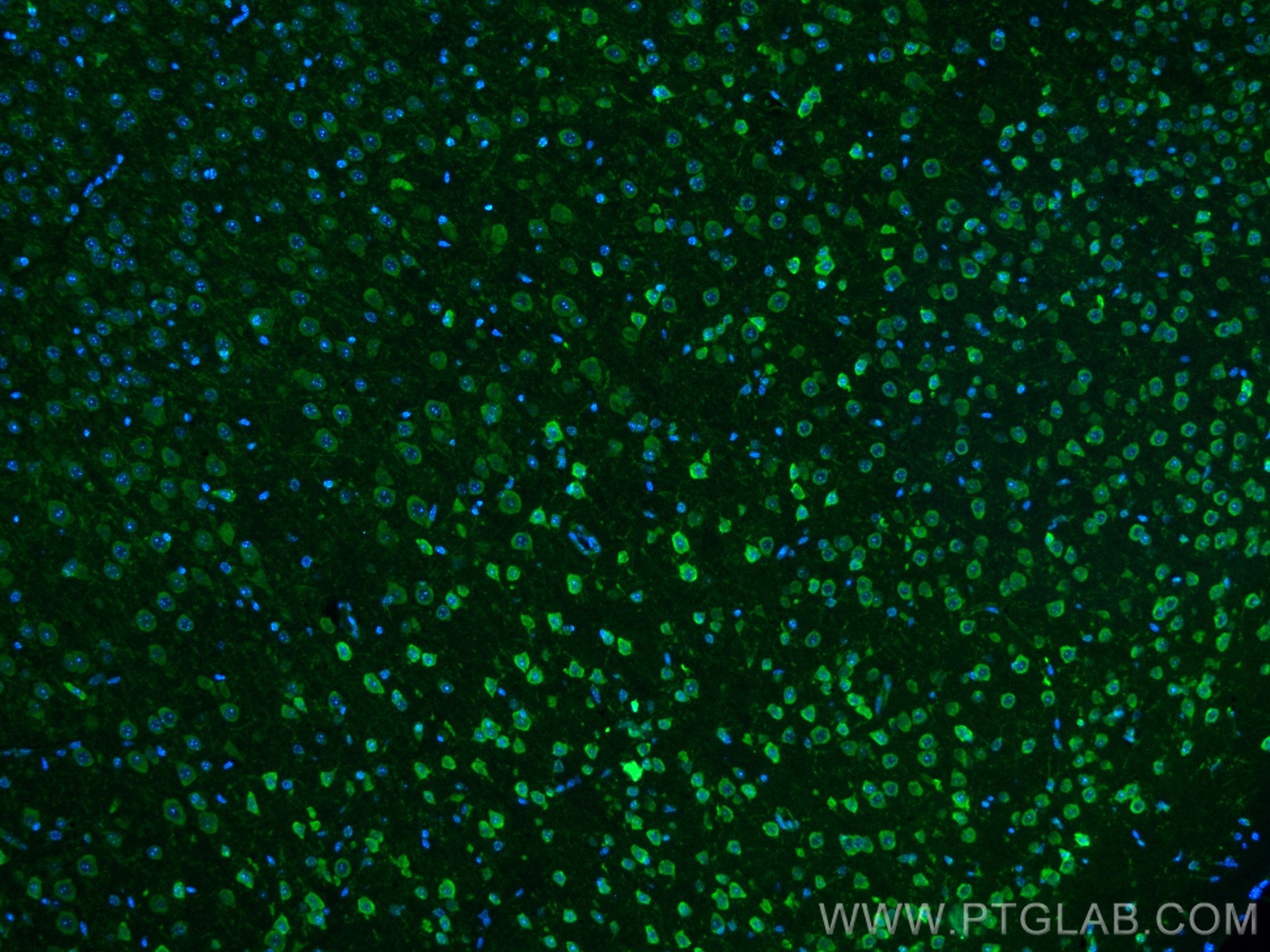 Immunofluorescence (IF) / fluorescent staining of mouse brain tissue using CoraLite® Plus 488-conjugated S1PR2 Polyclonal ant (CL488-21180)