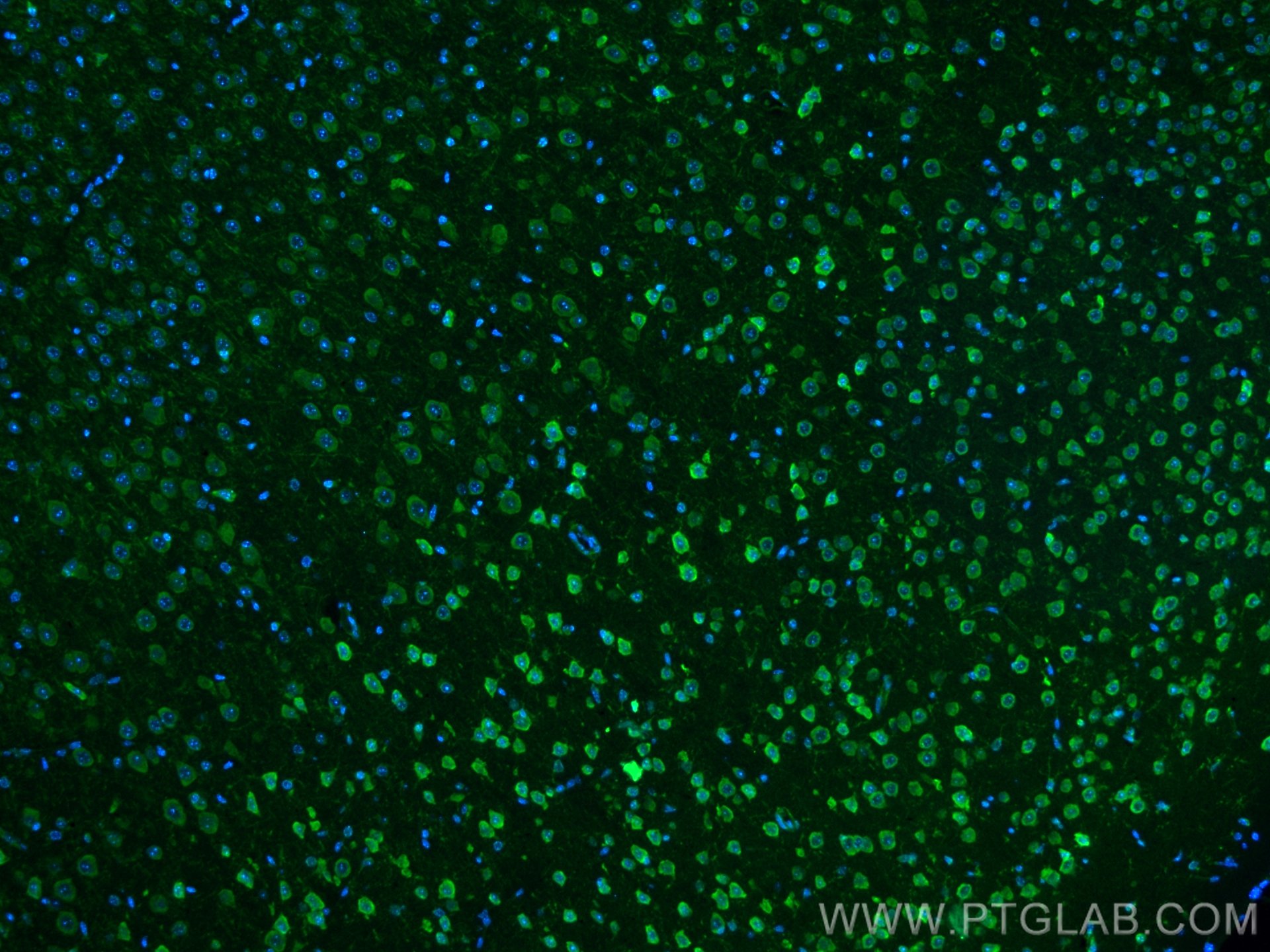 IF Staining of mouse brain using CL488-21180