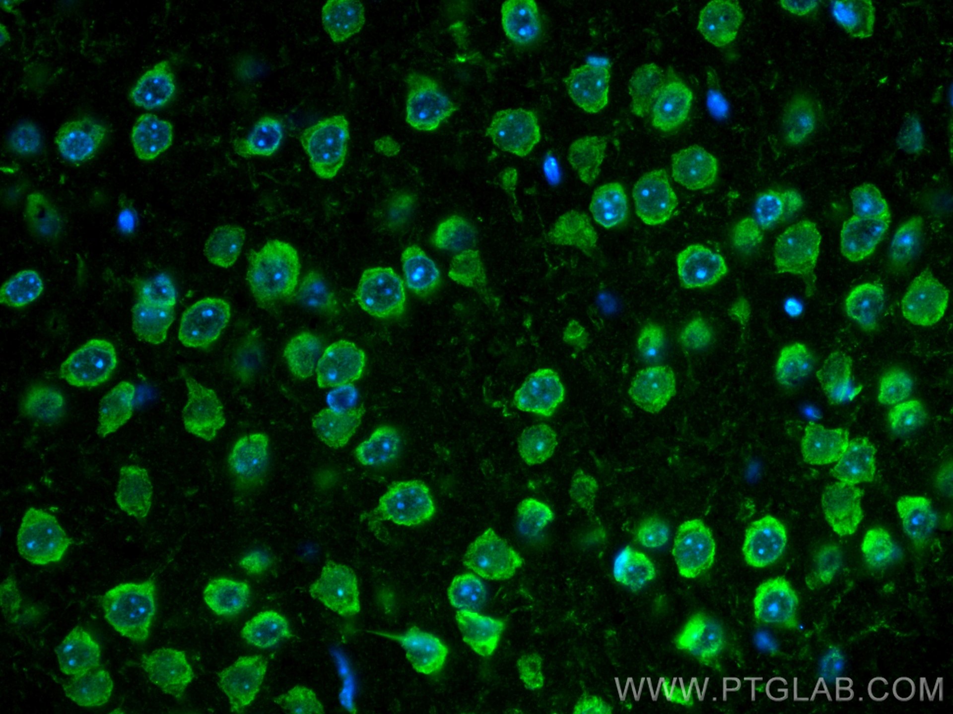 IF Staining of mouse brain using CL488-21180