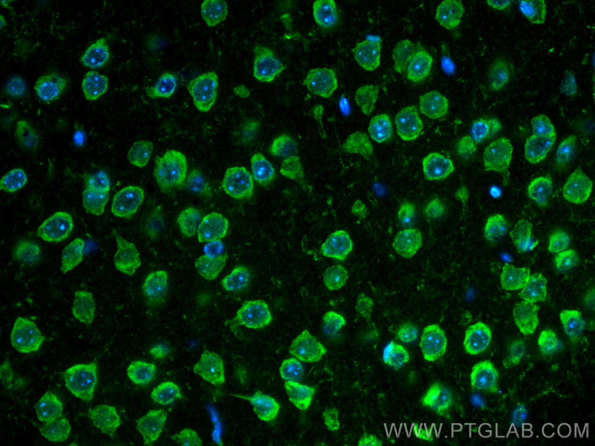 Immunofluorescence (IF) / fluorescent staining of mouse brain tissue using CoraLite® Plus 488-conjugated S1PR2 Polyclonal ant (CL488-21180)
