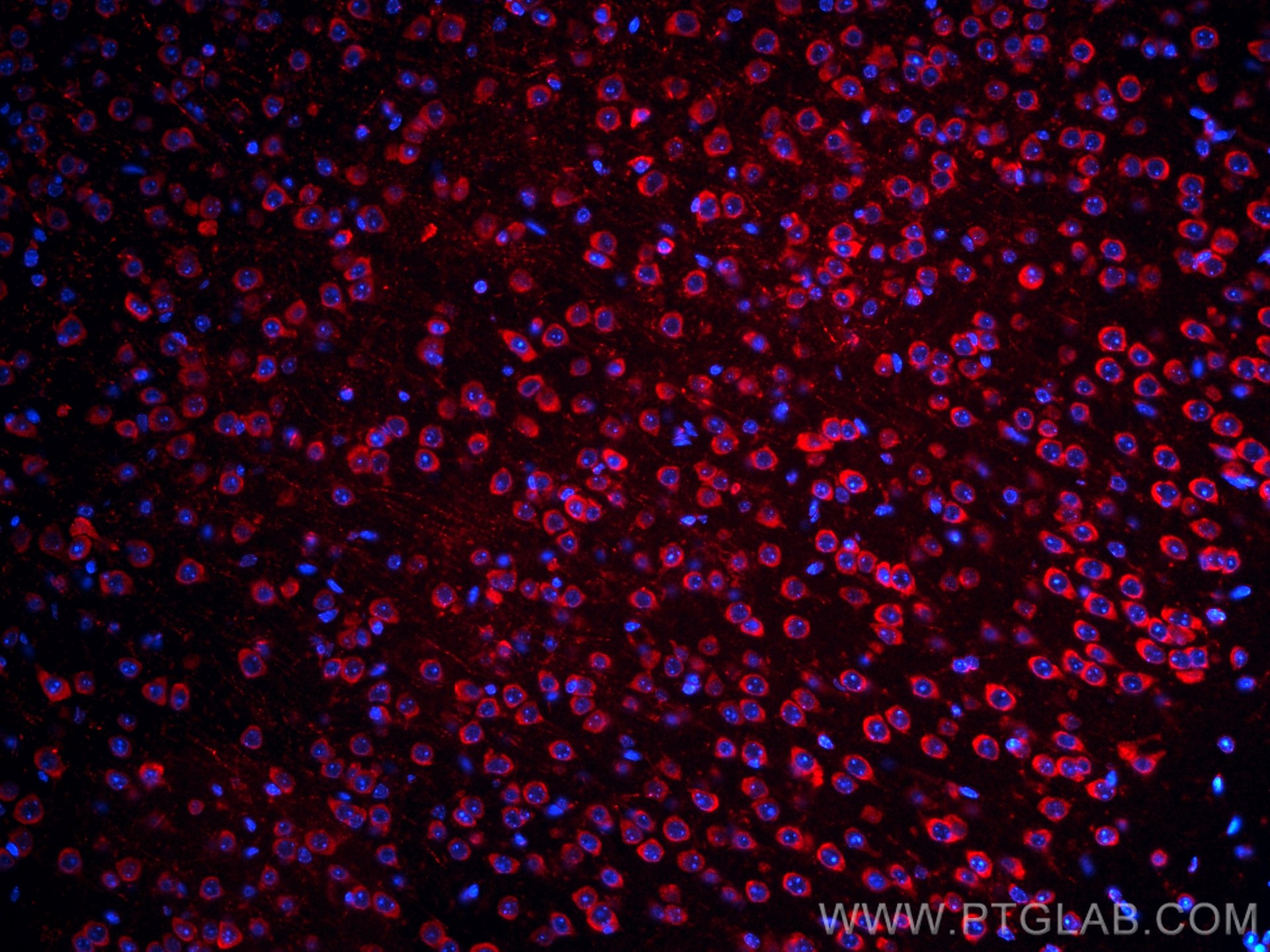 IF Staining of mouse brain using CL594-21180