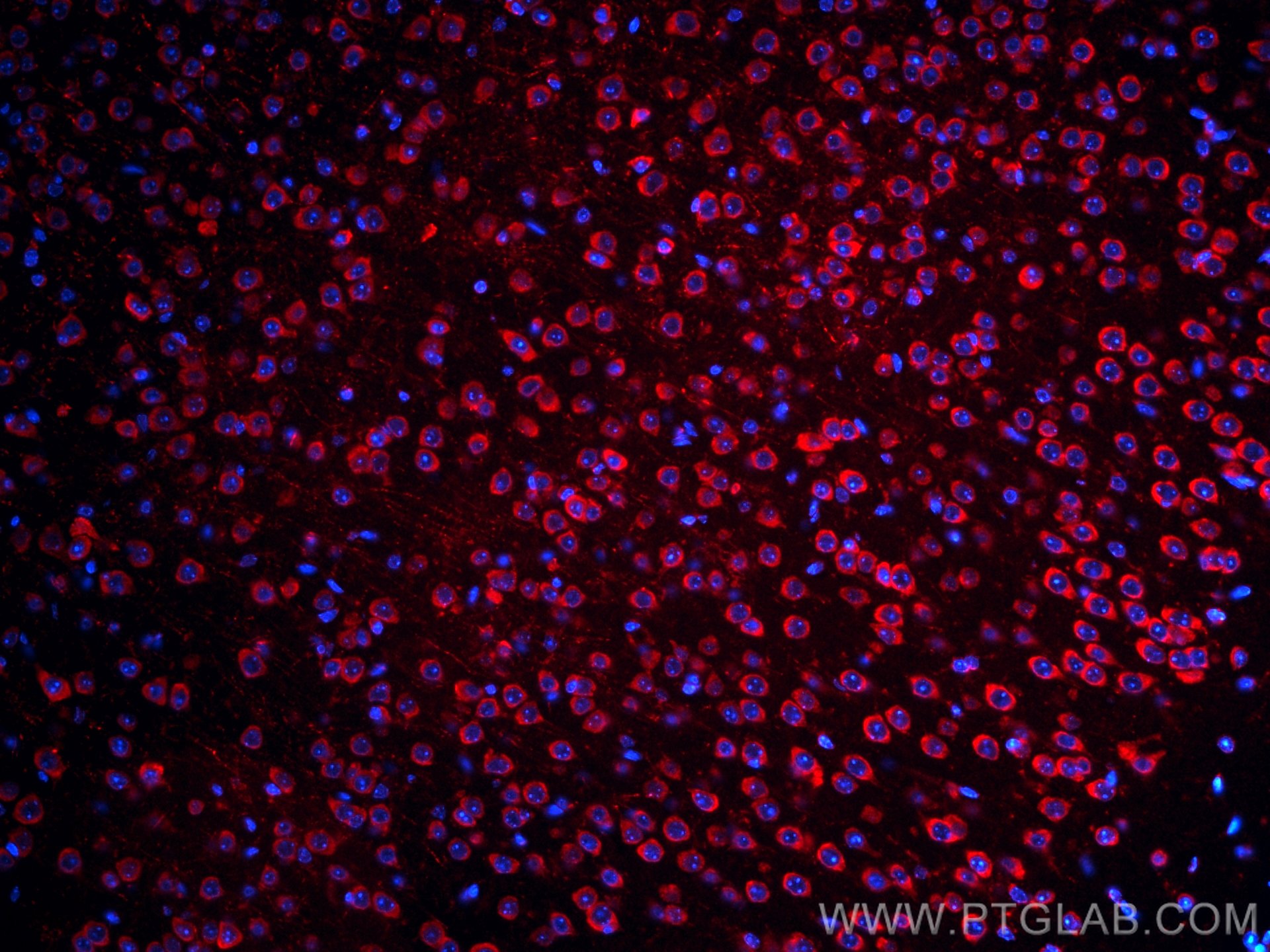 Immunofluorescence (IF) / fluorescent staining of mouse brain tissue using CoraLite®594-conjugated S1PR2 Polyclonal antibody (CL594-21180)