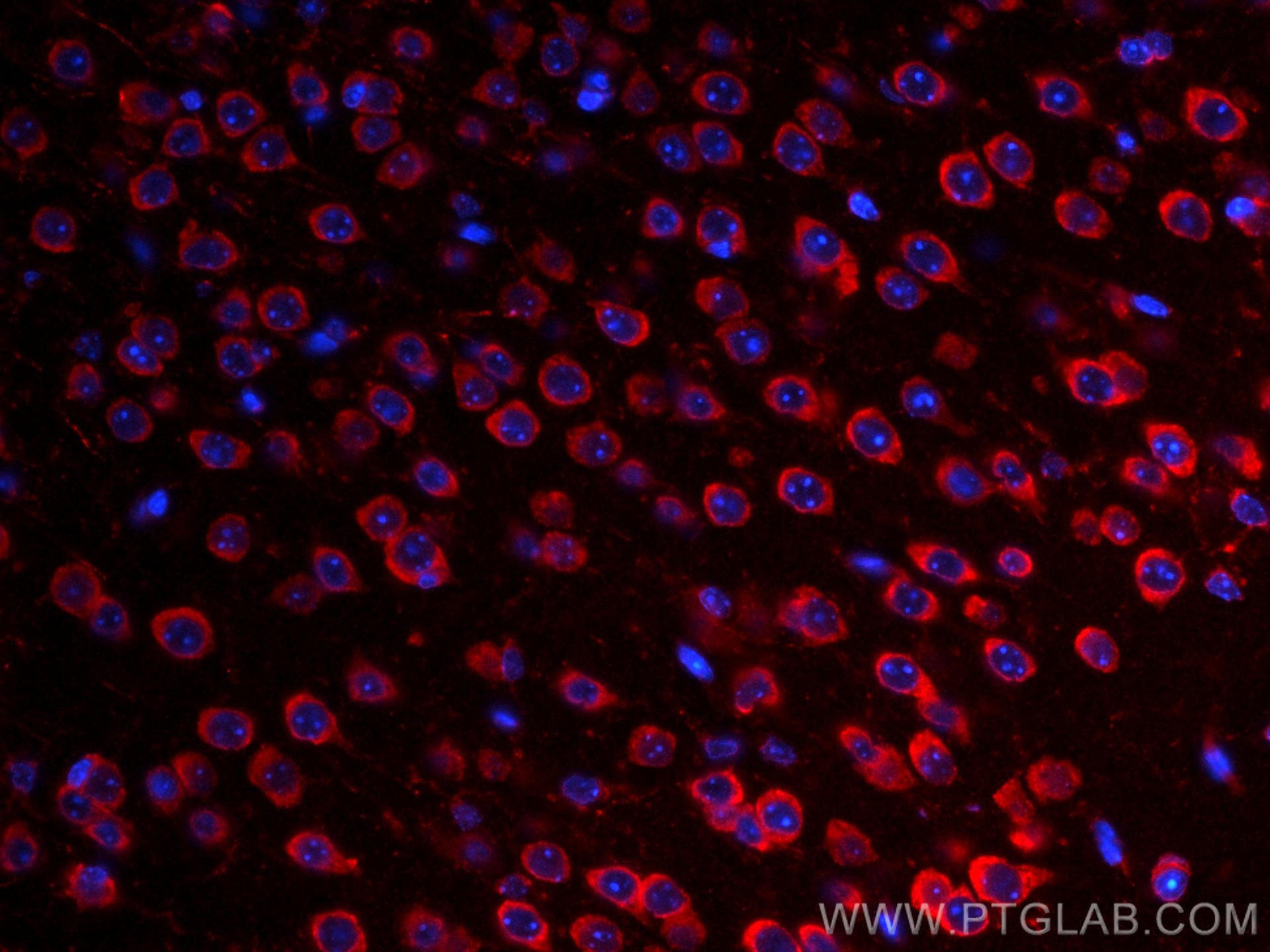 Immunofluorescence (IF) / fluorescent staining of mouse brain tissue using CoraLite®594-conjugated S1PR2 Polyclonal antibody (CL594-21180)