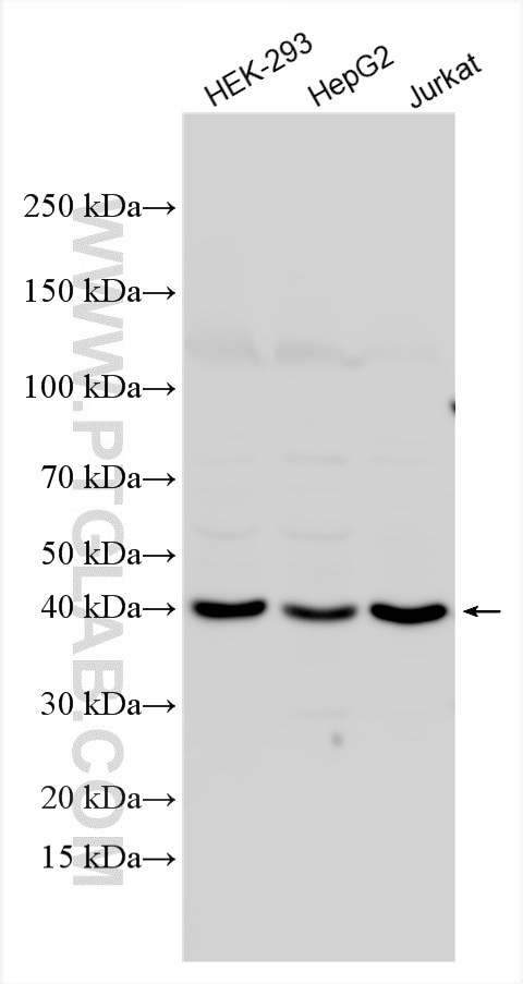 WB analysis using 55204-1-AP Western Blot (WB) analysis of various lysates using S1PR3 Polyclonal antibody (55204-1-AP)