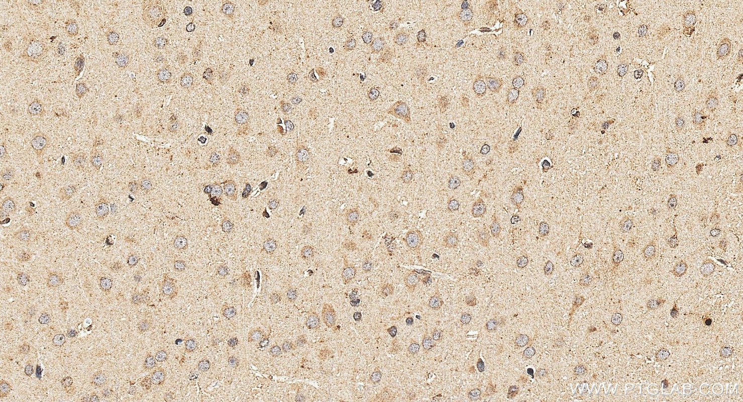 IHC staining of rat brain using 13874-1-AP Immunohistochemistry (IHC) staining of rat brain tissue using S1PR5/EDG8 Polyclonal antibody (13874-1-AP)