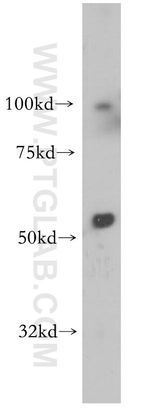 Western Blot (WB) analysis of K-562 cells using S1PR5/EDG8 Polyclonal antibody (13874-1-AP)